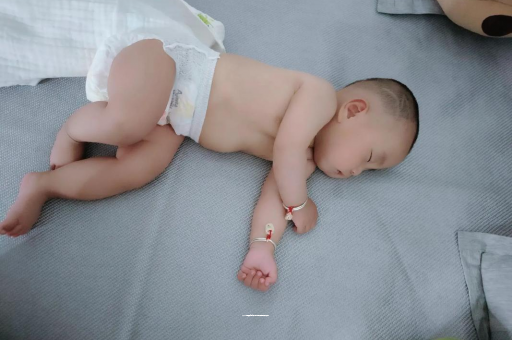 三沙宝宝褶皱处擦粉还是油